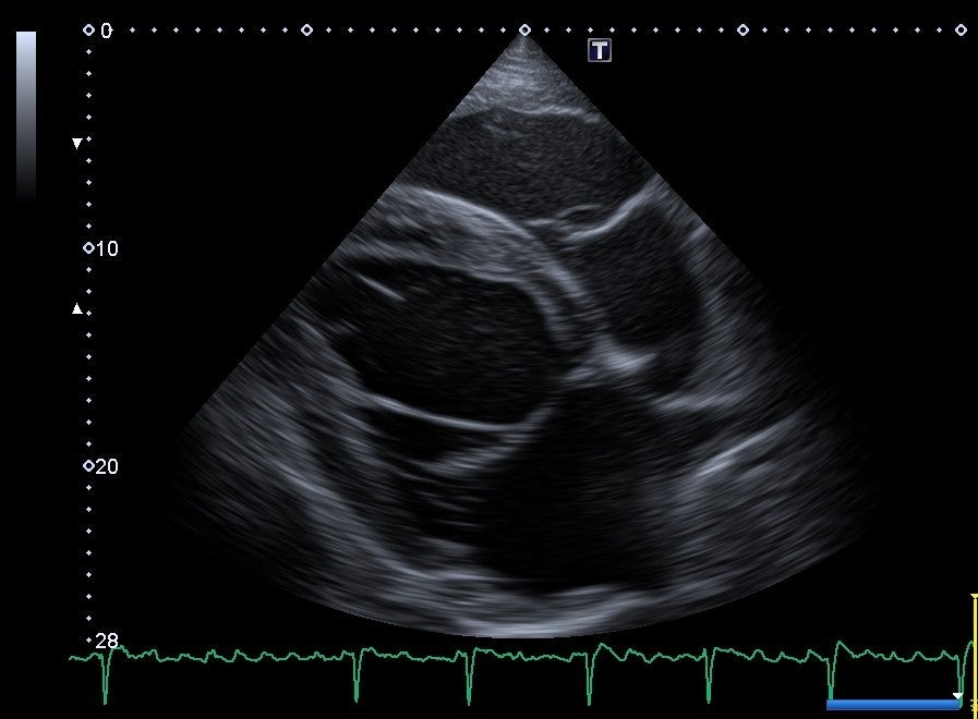 Echo afib horse Echo afib horse